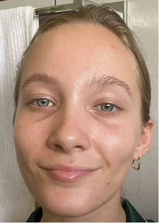 Après
